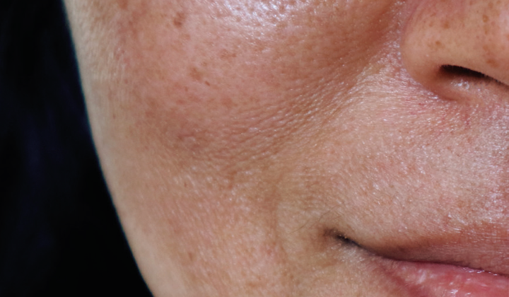 Trouver votre problématique peau | Esthétique Julie Blanchette